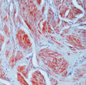 CALD1 / Caldesmon Antibody - Formalin-fixed, paraffin-embedded human uterus stained with peroxidase-conjugate and AEC chromogen. Note cytoplasmic staining of smooth muscles. This image was taken for the unmodified form of this product. Other forms have not been tested.