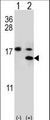 Calgizzarin / S100A11 Antibody - Western blot of S100A11 (arrow) using rabbit polyclonal S100A11 Antibody (S6). 293 cell lysates (2 ug/lane) either nontransfected (Lane 1) or transiently transfected (Lane 2) with the S100A11 gene.