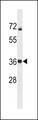 CALHM3 Antibody - CALHM3 Antibody western blot of A2058 cell line lysates (35 ug/lane). The CALHM3 antibody detected the CALHM3 protein (arrow).
