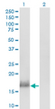 CALML3 Antibody - Western blot of CALML3 expression in transfected 293T cell line by CALML3 monoclonal antibody (M04), clone 2A11.