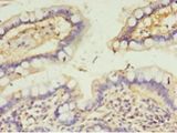 CALML4 Antibody - Immunohistochemistry of paraffin-embedded human small intestine tissue using antibody at 1:100 dilution.  This image was taken for the unconjugated form of this product. Other forms have not been tested.