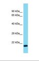 CALML4 Antibody - Western blot of Mouse Pancreas. Calml4 antibody dilution 1.0 ug/ml.  This image was taken for the unconjugated form of this product. Other forms have not been tested.