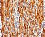 Calponin Antibody -  This image was taken for the unmodified form of this product. Other forms have not been tested.