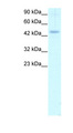 CALR / Calreticulin Antibody - CALR / Calreticulin antibody ARP30113_T100-NP_004334-CALR (calreticulin) Antibody Western blot of Daudi lysate.  This image was taken for the unconjugated form of this product. Other forms have not been tested.
