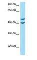 CAMK1 / CAMKI Antibody - CAMK1 / CAMKI antibody Western Blot of A549.  This image was taken for the unconjugated form of this product. Other forms have not been tested.
