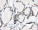 CAMK1D Antibody - IHC of paraffin-embedded thyroid tissue using anti-CAMK1D mouse monoclonal antibody. (Dilution 1:50).