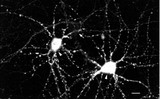 CAMK2 / CAMKII Antibody - CamKII (22B1), Dissociated hippocampal neurons.  This image was taken for the unconjugated form of this product. Other forms have not been tested.