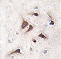 CAMK2D / CaMKII Delta Antibody - Formalin-fixed and paraffin-embedded human brain tissue reacted with CAMK2 delta Antibody , which was peroxidase-conjugated to the secondary antibody, followed by DAB staining. This data demonstrates the use of this antibody for immunohistochemistry; clinical relevance has not been evaluated.