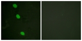 CAMK4 / CaMK IV Antibody - Immunofluorescence of HeLa cells, using CaMK4 (Phospho-Thr196/200) Antibody. The sample on the right was incubated with synthetic peptide.