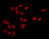 CaMKII Alpha+Beta+Delta Antibody - Staining COLO205 cells by IF/ICC. The samples were fixed with PFA and permeabilized in 0.1% Triton X-100, then blocked in 10% serum for 45 min at 25°C. The primary antibody was diluted at 1:200 and incubated with the sample for 1 hour at 37°C. An Alexa Fluor 594 conjugated goat anti-rabbit IgG (H+L) Ab, diluted at 1/600, was used as the secondary antibody.