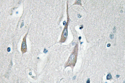 CaMKII Alpha+Delta Antibody - IHC of p-CaMKII/ (T286) pAb in paraffin-embedded human brain tissue.
