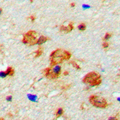 CaMKII Beta+Gamma Antibody - Immunohistochemical analysis of CaMK2 beta/gamma (pT287) staining in human brain formalin fixed paraffin embedded tissue section. The section was pre-treated using heat mediated antigen retrieval with sodium citrate buffer (pH 6.0). The section was then incubated with the antibody at room temperature and detected using an HRP-conjugated compact polymer system. DAB was used as the chromogen. The section was then counterstained with hematoxylin and mounted with DPX.