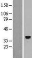 CAMKMT Protein - Western validation with an anti-DDK antibody * L: Control HEK293 lysate R: Over-expression lysate