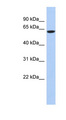 CAMKV Antibody - CAMKV antibody Western blot of 721_B cell lysate. This image was taken for the unconjugated form of this product. Other forms have not been tested.