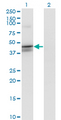 CANT1 Antibody - Western blot of CANT1 expression in transfected 293T cell line by CANT1 monoclonal antibody (M02), clone 1A1.