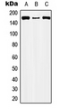 Capicua / CIC Antibody - Western blot analysis of CIC expression in HEK293T (A); Raw264.7 (B); PC12 (C) whole cell lysates.