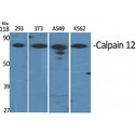 CAPN12 / Calpain 12 Antibody - Western blot of Calpain 12 antibody