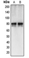 CAPN12 / Calpain 12 Antibody - Western blot analysis of Calpain 12 expression in HepG2 (A); A549 (B) whole cell lysates.