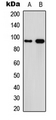 CAPN3 / Calpain 3 Antibody - Western blot analysis of Calpain 3 expression in MCF7 (A); PC12 (B) whole cell lysates.