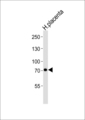 CAPN6 / Calpain 6 Antibody - Western blot of lysate from human placenta tissue lysate, using CAPN6 antibody diluted at 1:1000. A goat anti-mouse IgG H&L (HRP) at 1:3000 dilution was used as the secondary antibody. Lysate at 20 ug.
