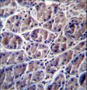 CAPN8 / Calpain 8 Antibody - CAPN8 Antibody immunohistochemistry of formalin-fixed and paraffin-embedded human stomach tissue followed by peroxidase-conjugated secondary antibody and DAB staining.