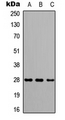 CAPNS2 Antibody - Western blot analysis of CAPNS2 expression in HeLa (A); NS-1 (B); H9C2 (C) whole cell lysates.