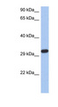 CAPZA3 Antibody - CAPZA3 antibody Western blot of DU145 cell lysate. This image was taken for the unconjugated form of this product. Other forms have not been tested.
