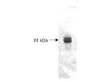Carboxypeptidase Y Antibody - Anti-Carboxypeptidase Antibody - Western Blot. Both the antiserum and IgG fractions of anti-Carboxypeptidase Y (Bakers Yeast) are shown to detect under reducing conditions of SDS-PAGE the 61000 dalton enzyme in cellular extracts. Approximately 10 ug of total protein is loaded per lane. A 1:5000 dilution of the primary antibody is used followed by detection using HRP Goat-a-Rabbit IgG [H&L] (LS-C60884) diluted 1:4000 and color development using 4-CN substrate until sufficient color develops. Other detection systems will yield similar results.