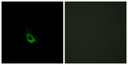 CARD10 / CARMA3 Antibody - Immunofluorescence analysis of HeLa cells, using CARD10 Antibody. The picture on the right is blocked with the synthesized peptide.