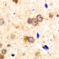 CARMA1 / CARD11 Antibody - Immunohistochemical analysis of CARD11 staining in human brain formalin fixed paraffin embedded tissue section. The section was pre-treated using heat mediated antigen retrieval with sodium citrate buffer (pH 6.0). The section was then incubated with the antibody at room temperature and detected with HRP and DAB as chromogen. The section was then counterstained with hematoxylin and mounted with DPX.