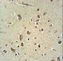 CARNS1 Antibody - ATPGD1 antibody immunohistochemistry of formalin-fixed and paraffin-embedded human brain tissue followed by peroxidase-conjugated secondary antibody and DAB staining.