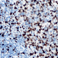 CARP / ANKRD1 Antibody - Immunohistochemical analysis of ANKRD1 staining in human lymph node formalin fixed paraffin embedded tissue section. The section was pre-treated using heat mediated antigen retrieval with sodium citrate buffer (pH 6.0). The section was then incubated with the antibody at room temperature and detected using an HRP conjugated compact polymer system. DAB was used as the chromogen. The section was then counterstained with hematoxylin and mounted with DPX.