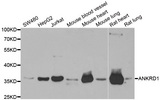 CARP / ANKRD1 Antibody - Western blot analysis of extracts of various cell lines.