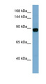 CASD1 Antibody - CASD1 antibody Western blot of THP-1 cell lysate. This image was taken for the unconjugated form of this product. Other forms have not been tested.