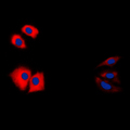 CASP1 / Caspase 1 Antibody - Immunofluorescent analysis of Caspase 1 p10 staining in HeLa cells. Formalin-fixed cells were permeabilized with 0.1% Triton X-100 in TBS for 5-10 minutes and blocked with 3% BSA-PBS for 30 minutes at room temperature. Cells were probed with the primary antibody in 3% BSA-PBS and incubated overnight at 4 C in a humidified chamber. Cells were washed with PBST and incubated with a DyLight 594-conjugated secondary antibody (red) in PBS at room temperature in the dark. DAPI was used to stain the cell nuclei (blue).