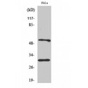 CASP10 / Caspase 10 Antibody - Western blot of Caspase-10 B/C antibody