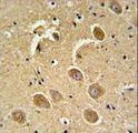 CASP3 / Caspase 3 Antibody - CASP3(Asp175) Antibody IHC of formalin-fixed and paraffin-embedded human brain tissue followed by peroxidase-conjugated secondary antibody and DAB staining.