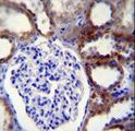 CASP3 / Caspase 3 Antibody - CASP3 Antibody immunohistochemistry of formalin-fixed and paraffin-embedded human kidney tissue followed by peroxidase-conjugated secondary antibody and DAB staining.