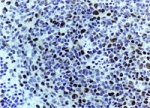 CASP3 / Caspase 3 Antibody - Formalin-fixed, paraffin-embedded section of irradiated mouse spleen stained for Active/Cleaved Caspase-3 expression using Polyclonal Antibody to Active/Cleaved Caspase-3 at 1:2000. Staining is seen in the nuclei of a subset of the cell population. Caspase-3 expression in the nucleus is considered to be a marker of active/caspase-3 expression and apoptosis. Hematoxylin-Eos in counterstain.