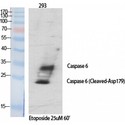 CASP6 / Caspase 6 Antibody - Western blot of Cleaved-Caspase-6 p18 (D179) antibody
