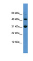 CASP7 / Caspase 7 Antibody - CASP7 / Caspase 7 antibody Western blot of OVCAR-3 cell lysate. This image was taken for the unconjugated form of this product. Other forms have not been tested.
