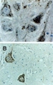 CASP9 / Caspase 9 Antibody - Formalin-fixed, paraffin-embedded dog brain sections stained for cleaved Caspase-9 expression using Polyclonal Antibody to (Active) Cleaved Caspase-9 antibody at 1:2000. A. Section from a dog brain 2 hr after reperfusion injury. B. Section from a dog brain sham control (brain surgery but no injury). Hematoxylin-Eos in counterstain.