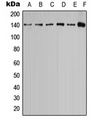CASR/Calcium Sensing Receptor Antibody - Western blot analysis of Calcium Sensing Receptor (pT888) expression in MCF7 (A); MDCK (B); U2OS (C); SP2/0 (D); PC12 (E); rat brain (F) whole cell lysates.