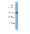 CASS4 Antibody - Western blot of Human RPMI-8226. CASS4 antibody dilution 1.0 ug/ml.  This image was taken for the unconjugated form of this product. Other forms have not been tested.