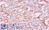CAST / Calpastatin Antibody - Immunohistochemistry of paraffin-embedded human kidney using CAST / Calpastatin antibody at dilution of 1:10.  This image was taken for the unconjugated form of this product. Other forms have not been tested.