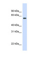 CAT / Catalase Antibody - CAT / Catalase antibody Western blot of Fetal Heart lysate. This image was taken for the unconjugated form of this product. Other forms have not been tested.