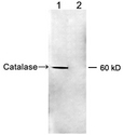 CAT / Catalase Antibody - Western blot of HeLa cell lysate using 2 ug/ml Rabbit Anti-Catalase Polyclonal Antibody. Lane 1. Rabbit Anti-Catalase Polyclonal Antibody. Lane 2. Rabbit Anti-Catalase Polyclonal Antibody pre-incubated with immunizing peptide. The signal was developed with IRDye 800 Conjugated Goat Anti-Rabbit IgG.
