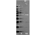 CAT / Catalase Antibody - Western Blot of Rabbit Anti-Catalase antibody. Lane R: Reduced samples of purified Catalase. Lane NR: Non-reduced samples of purified Catalase. Load: ~1ug of protein per lane. Primary antibody: Catalase antibody at 1:1000 for overnight at 4 degrees C. Secondary antibody: Dylight488 alpha rabbit secondary antibody at 1:10,000 for 1.5 hrs at RT. Block: MB-070 overnight at 4 degrees C. Predicted/Observed size: 59.9 kDa, 55 kDa for Catalase. Other band(s): none. This image was taken for the unconjugated form of this product. Other forms have not been tested.