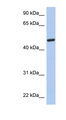 CATIP / C2orf62 Antibody - C2orf62 antibody Western blot of Fetal Brain lysate. This image was taken for the unconjugated form of this product. Other forms have not been tested.