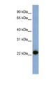 CAV1 / Caveolin 1 Antibody - CAV1 / Caveolin antibody Western blot of Fetal Liver lysate. This image was taken for the unconjugated form of this product. Other forms have not been tested.